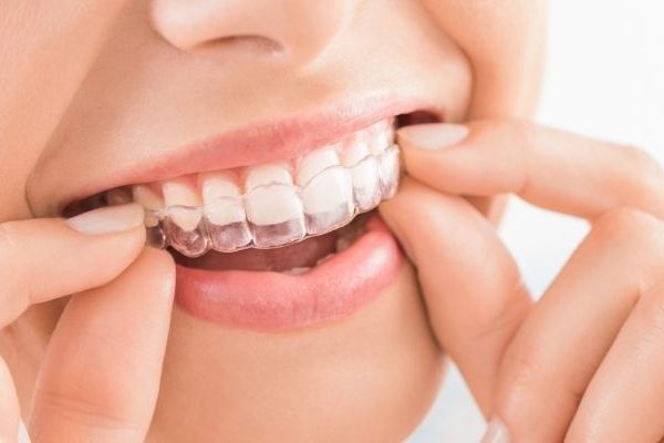 Şeffaf Plak Tedavisi Nedir, Kimlere Uygulanır?