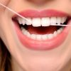 5 Maddede Diş İpi Nedir Nasıl Kullanmalıyız