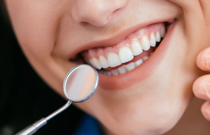 Diş Estetiği Öncesi Bilinmesi Gerekenler