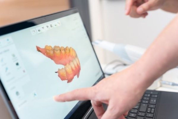 Kemik Tozu Uygulamaları ( Bone Grefting )