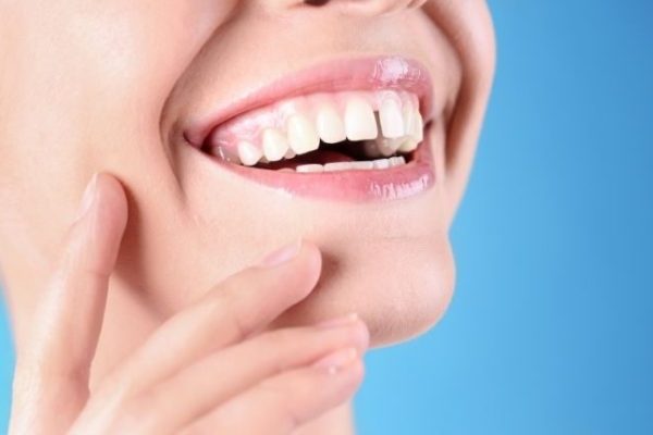 Ayrık Diş Sorunları Özgüveninizi Zedelemesin